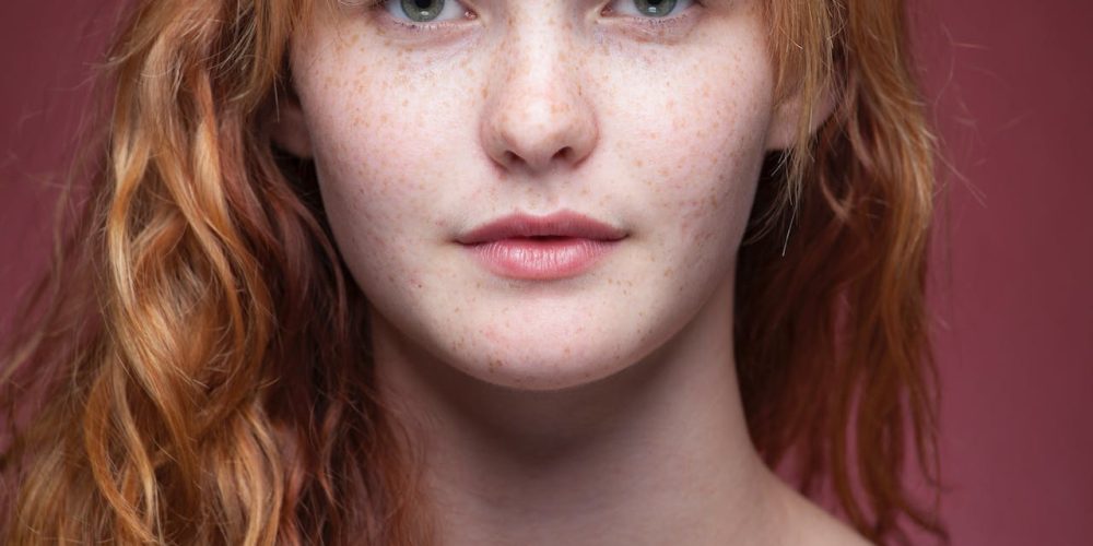 carcinome et mélanome, grain de beauté et naevus